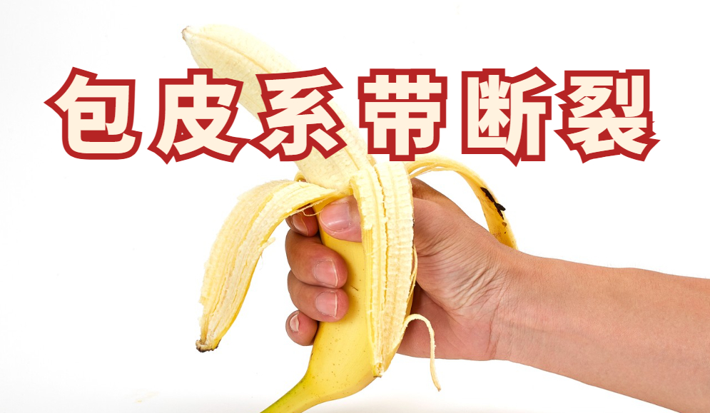 包皮系带断裂