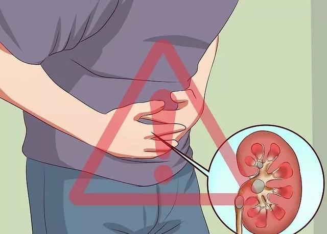 男性肾病如何避免恶化？