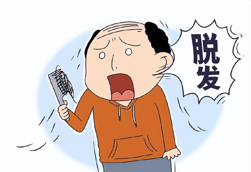 男性脱发