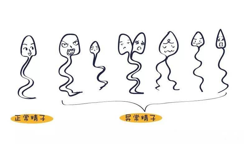 精子质量差